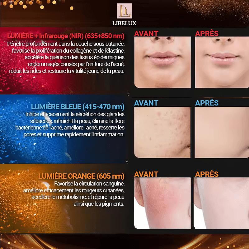 LUMI™ | Masque visage LED - LIBELUX