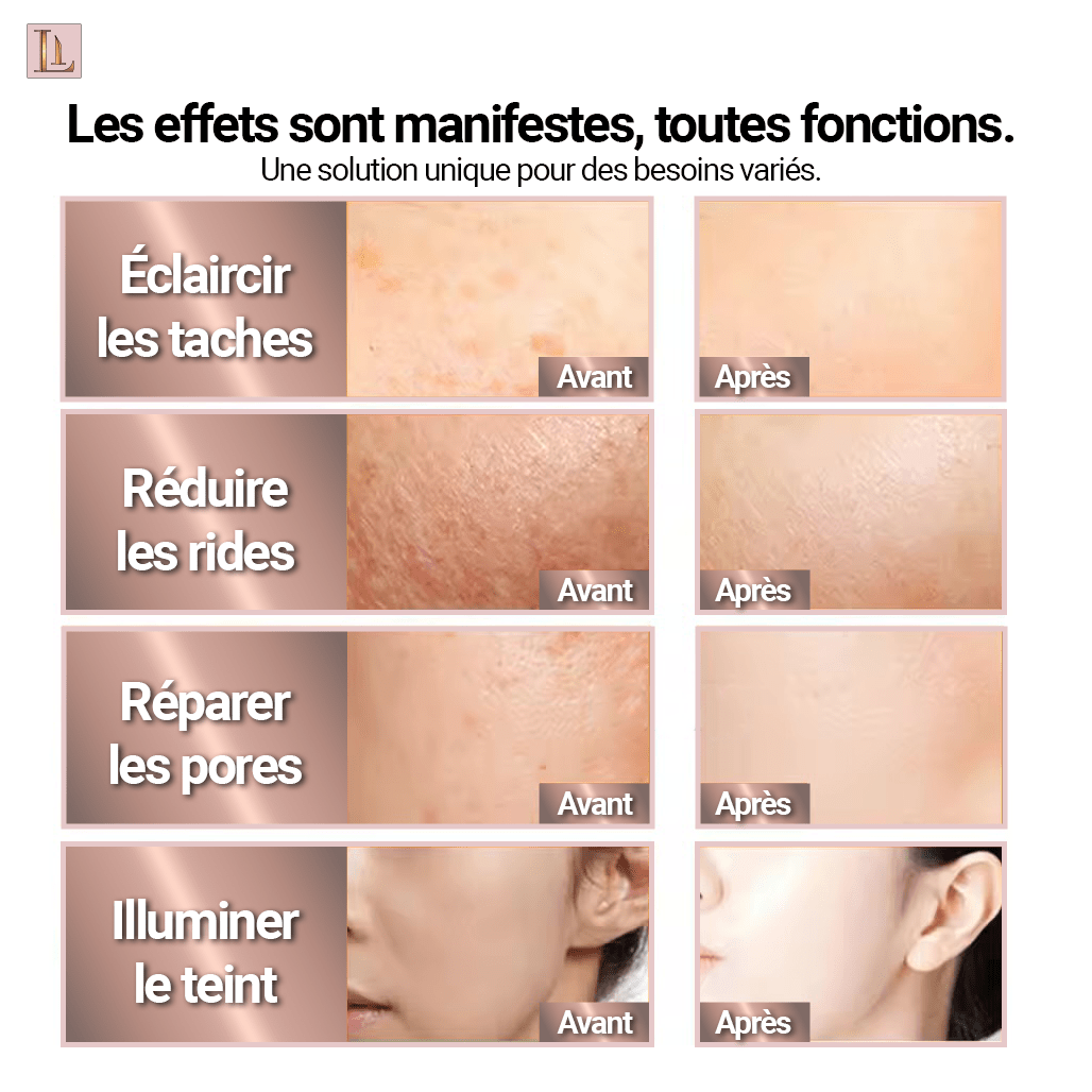 Roll - on aiguille NDRoll™️ | Régénérateur Collagène - LIBELUX